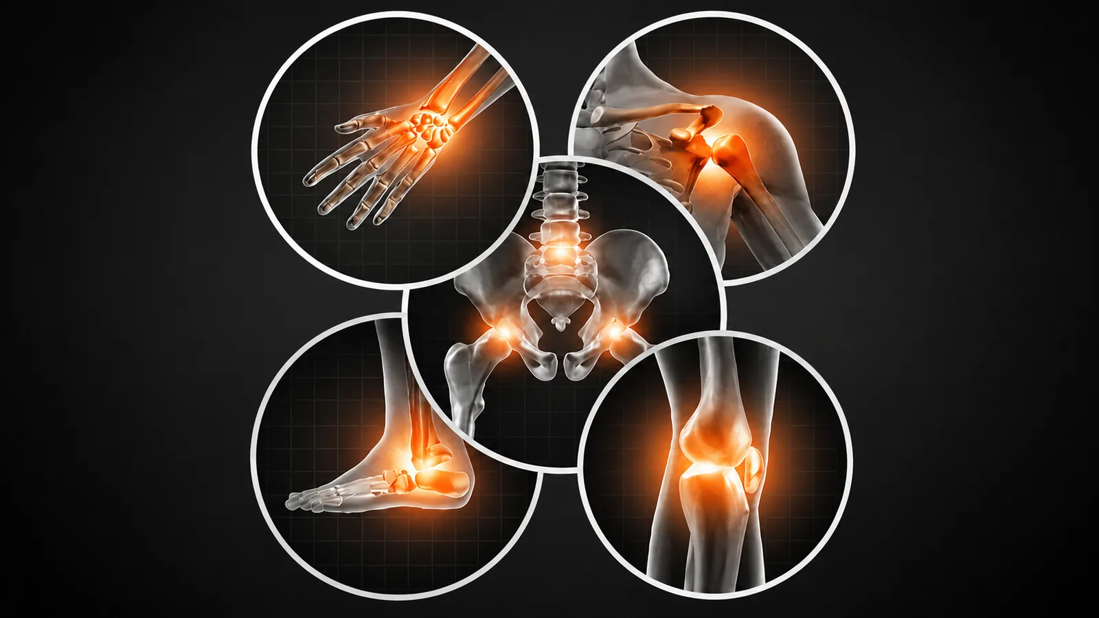 General orthopedic evaluation at LAOSS